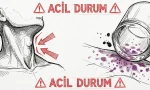 Saniyelerin Önem Kazandığı An: Menenjit "Kırmızı Alarm" Belirtileri Listesi